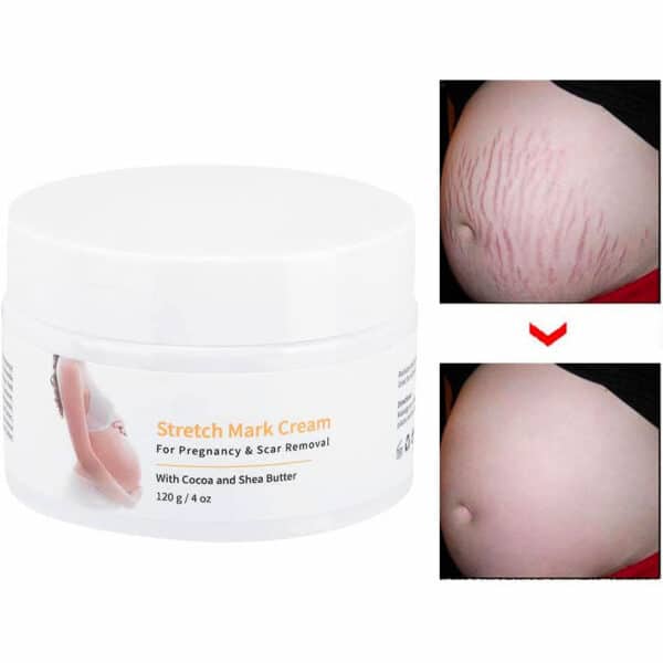 Melao Stretch Mark Cream For Pregnancy And Scar Removal With Cocoa And Shea Butter 10