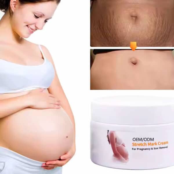 Melao Stretch Mark Cream For Pregnancy And Scar Removal With Cocoa And Shea Butter 2