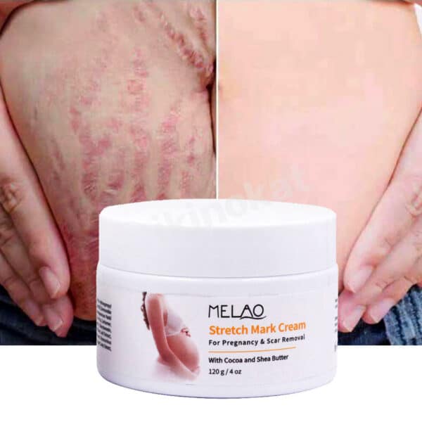 Melao Stretch Mark Cream For Pregnancy And Scar Removal With Cocoa And Shea Butter 3