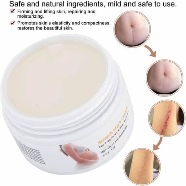 Melao Stretch Mark Cream For Pregnancy And Scar Removal With Cocoa And Shea Butter 5