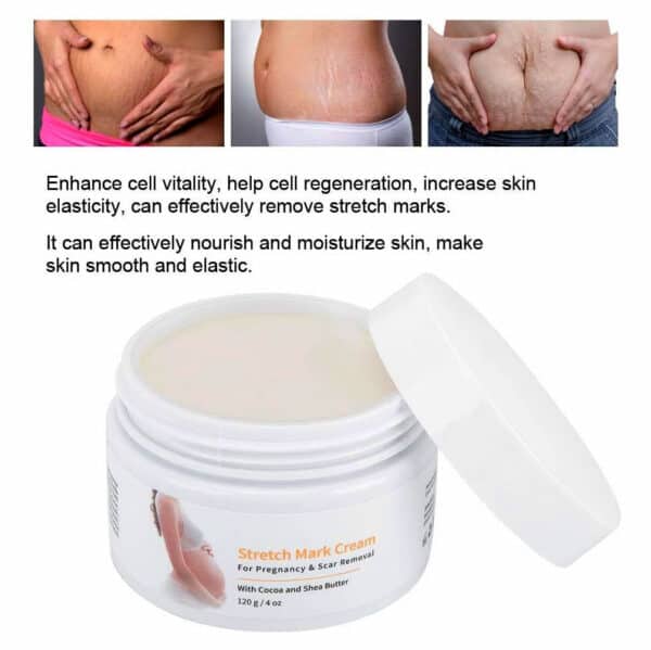 Melao Stretch Mark Cream For Pregnancy And Scar Removal With Cocoa And Shea Butter 6