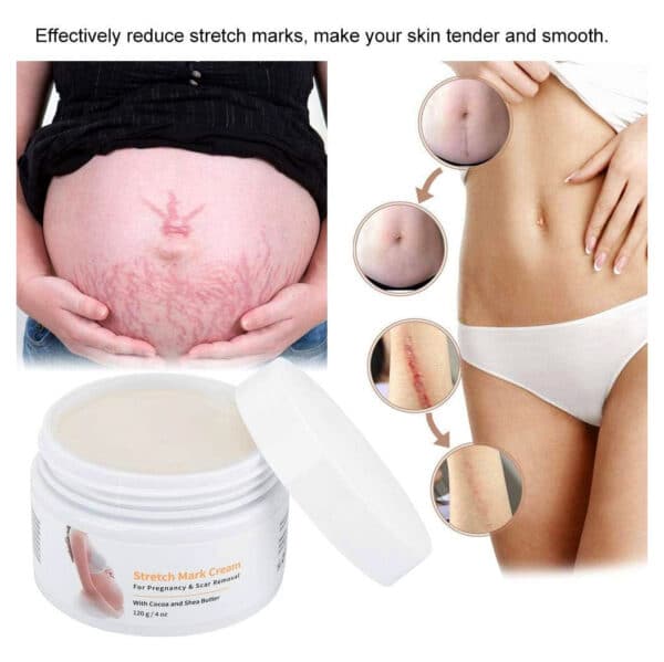 Melao Stretch Mark Cream For Pregnancy And Scar Removal With Cocoa And Shea Butter 7